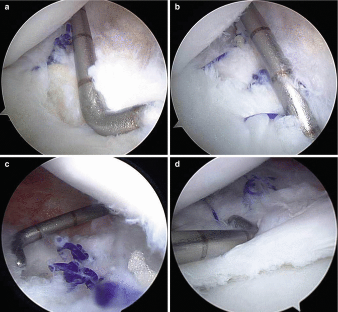 figure 18