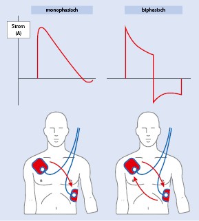 Kardiopulmonale Reanimation (CPR) | SpringerLink