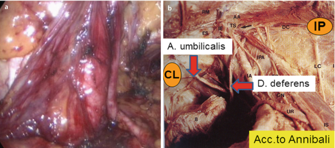 figure 16