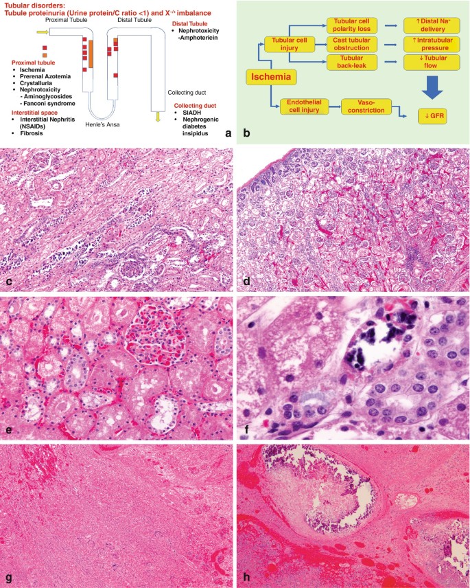 https://media.springernature.com/lw685/springer-static/image/chp%3A10.1007%2F978-3-662-59169-7_6/MediaObjects/308503_1_En_6_Fig21_HTML.jpg