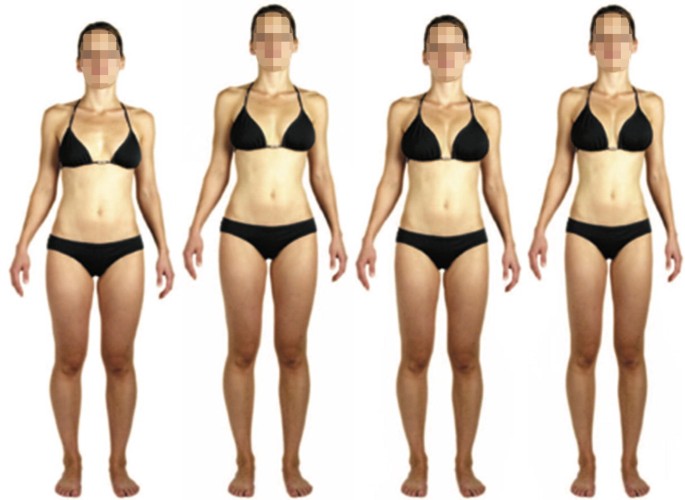 Aesthetic Surgery And Sport Springerlink