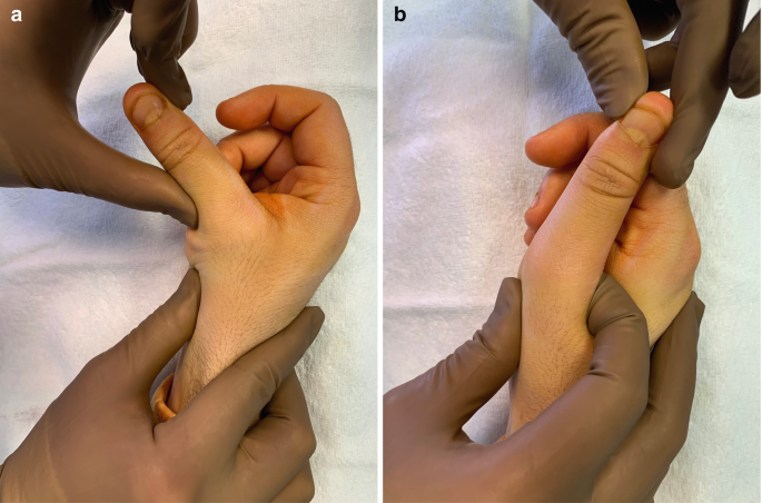 Common basketball finger injuries