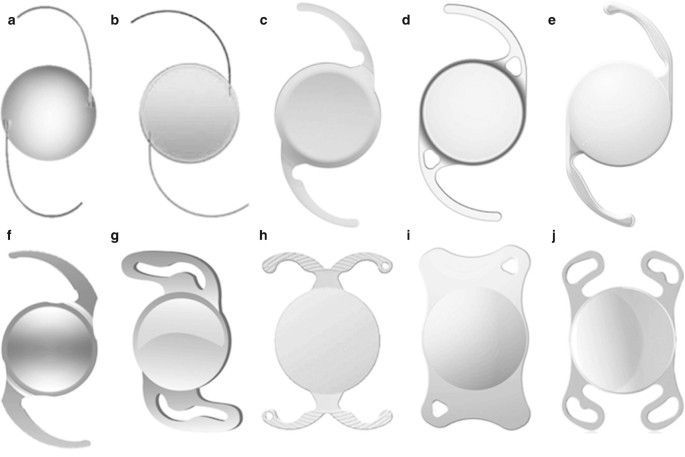 Design und Material von Intraokularlinsen | Springer Nature Link