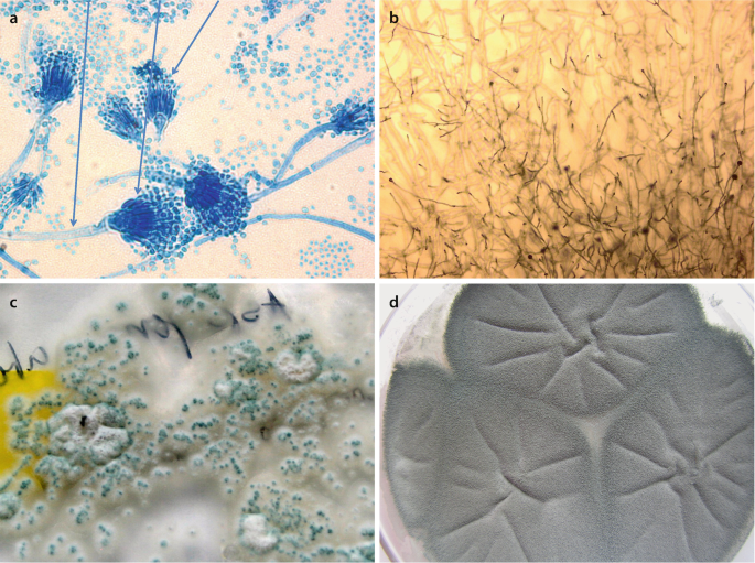 Cladosporium Kolonie