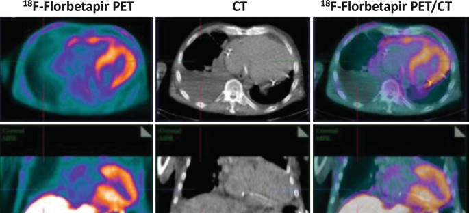 figure 28