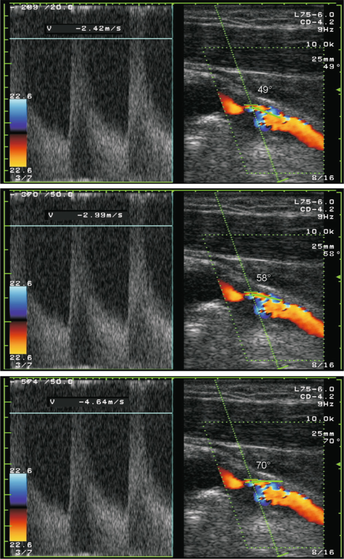 figure 21