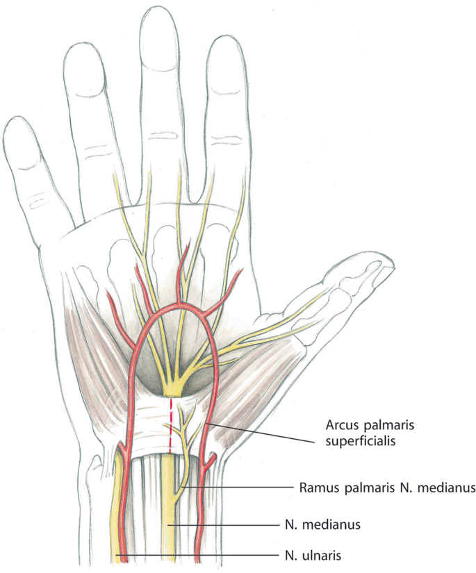 Kompressionssyndrome des N. medianus