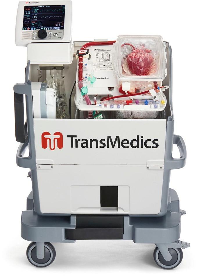 Heart Transplantation | Springer Nature Link