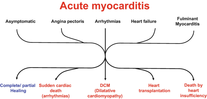 Myocarditis | Springer Nature Link