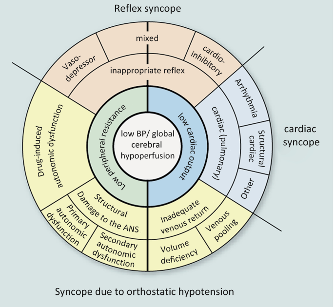 Syncope Examples Syncope | Springer Nature Link