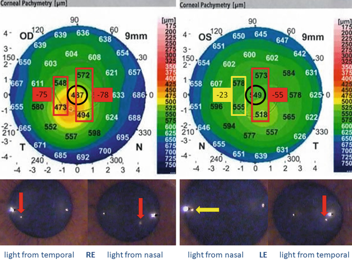 Cornea | SpringerLink