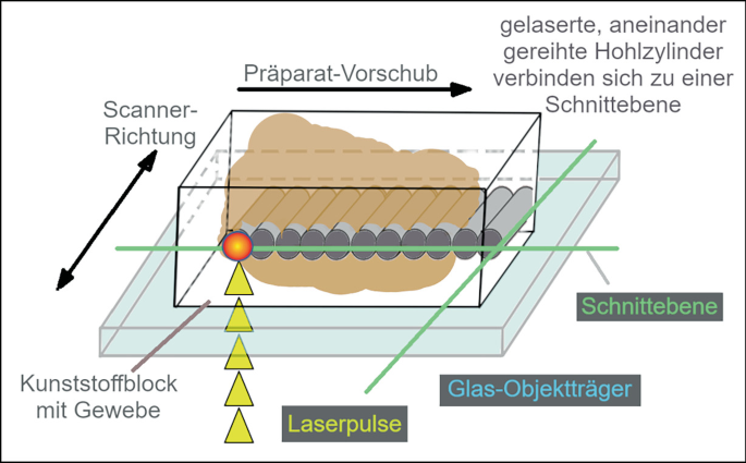 schrank aufbewahrung organizer Mdurian Stapelbare Regal Kleiderschrank Schubladenbox Teiler Kleideraufbewahrungskorbhalter Schrank-Organizer für Kleidung Küchen Schlafzimmer Küche, Haushalt & Wohnen kleine burger patties Griffe:rundes Leder Idea Nuova zusammenklappbarer Aufbewahrungswürfel