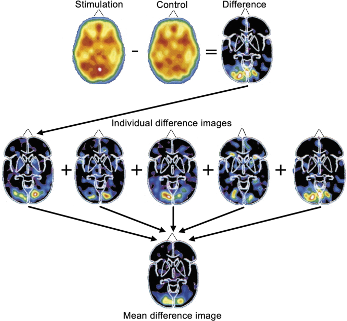 Brain Metabolism and Cognition: Cerebral Blood Flow Measurement and ...