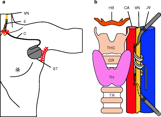 figure 00073