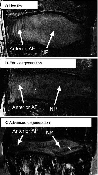 figure 00024