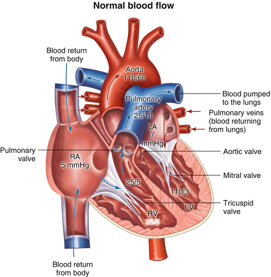 Normal heart anatomy. LA, left atrium; LV, left ventricle; RA, ri ght