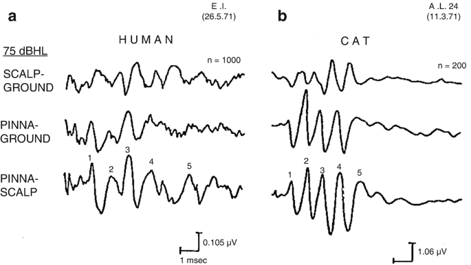 In an image of two sets of wave patterns, the right side has the response of the human and the left side has the response of the cat. i. scalp-ground, ii. pinna-ground and iii. pinna-scalp. The graph below a with the x-axis as the time and the y-axis as 0.105 microvolts and below b with the x-axis as time and the y-axis as 1.05 microvolts.