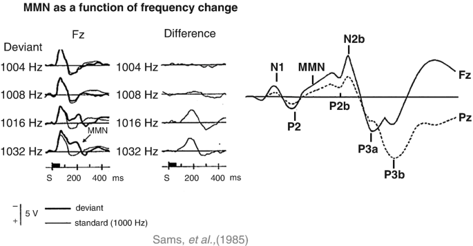 An image of multiple waveforms at different frequencies of Fz and the difference, titled M M N as a function of frequency change. The key below it depicts deviant and standard lines with negative and positive voltages, and the line depicts the time. The graph on the right with N 1, P 2, M M N, P 2b, N 2b, P3a, and P3b is marked on Fz and Pz waves.