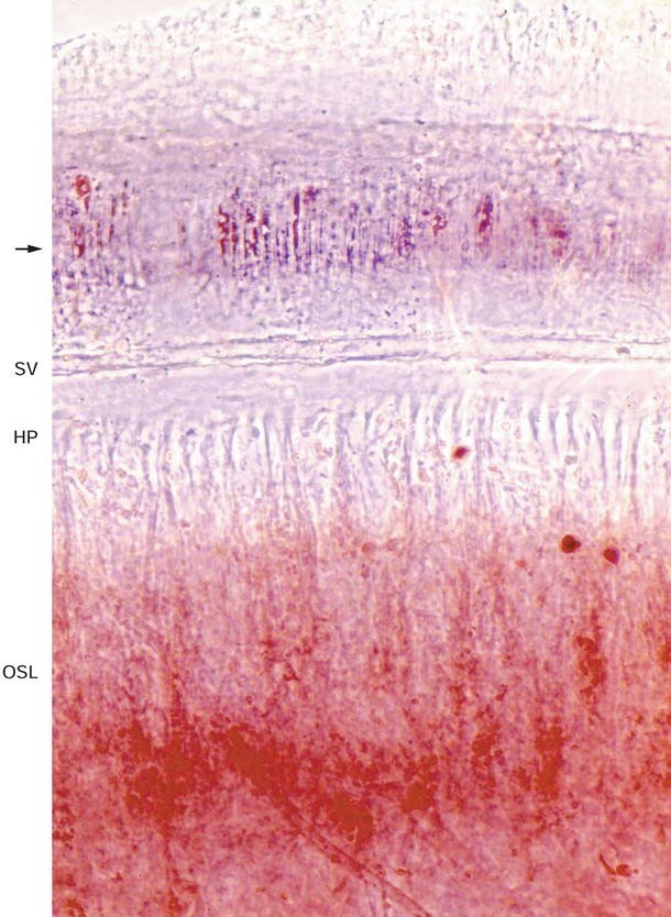 figure 26