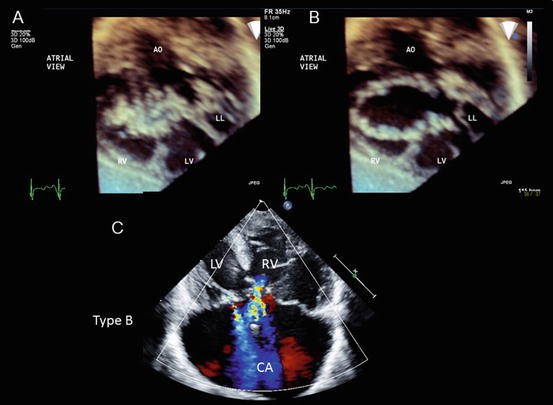 figure 14