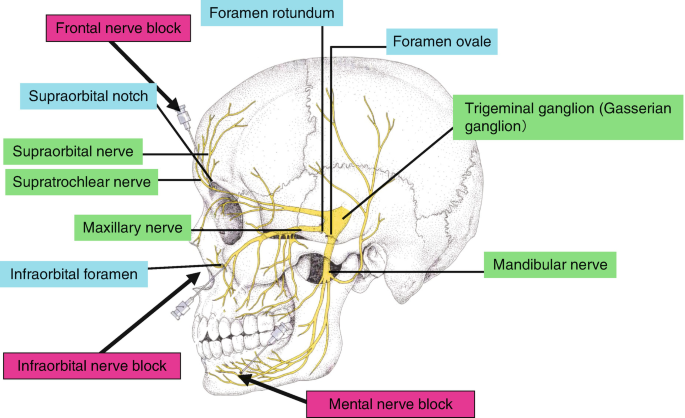 Trigeminal Nerve Block | SpringerLink