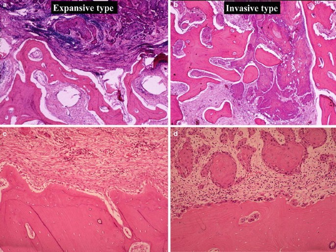 figure 28