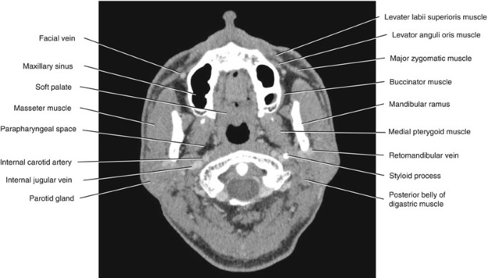 figure 23