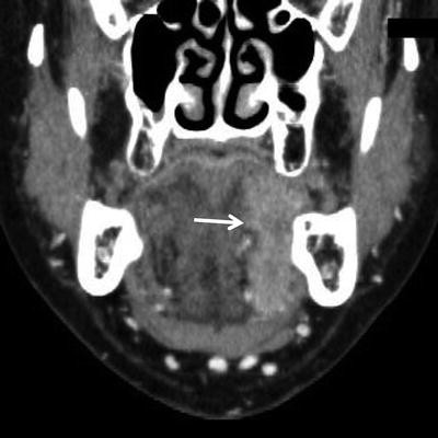 figure 55