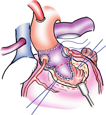 figure 14