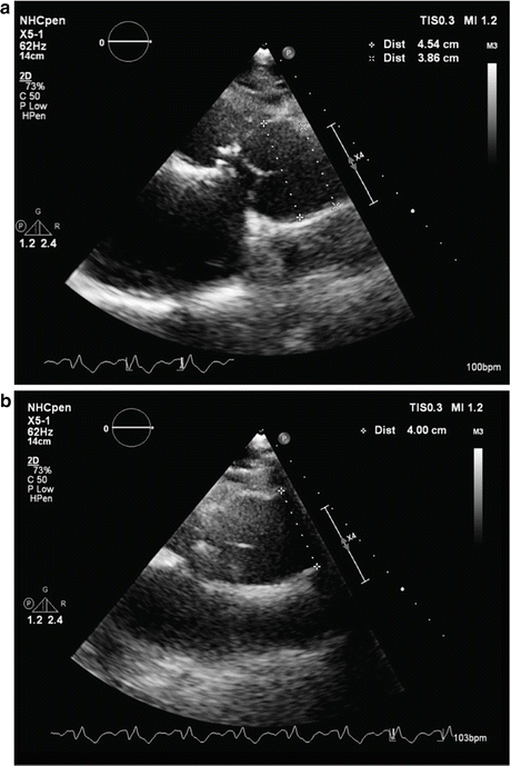 figure 27