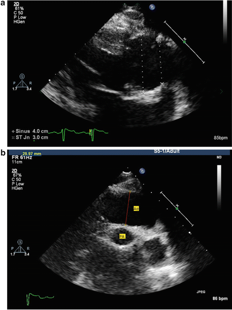 figure 35