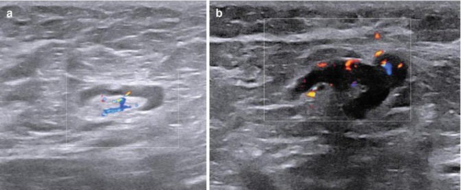 figure 28