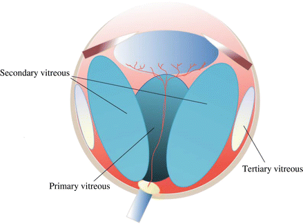Grades of Vitreous Clarity | SpringerLink