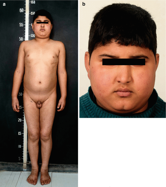 pediatric nude photos  puberty developmentnude family photography Daughterpedomom  boys  file 01 Disorders of Growth and Development: Clinical Perspectives | SpringerLink