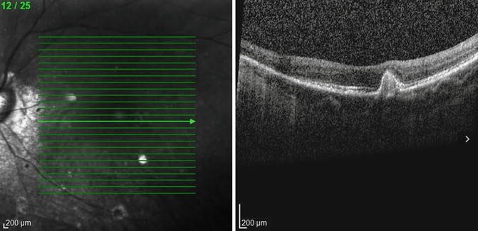 figure 19