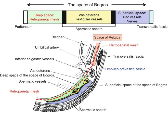 Surgical Anatomy of Groin and Groin Hernia | SpringerLink