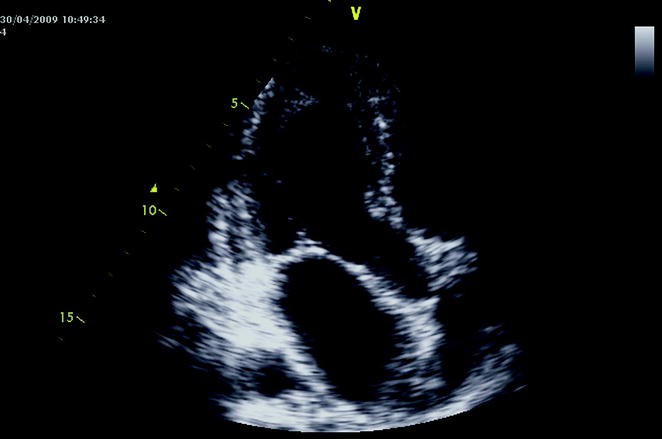 figure 18