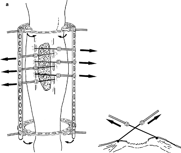 figure 21