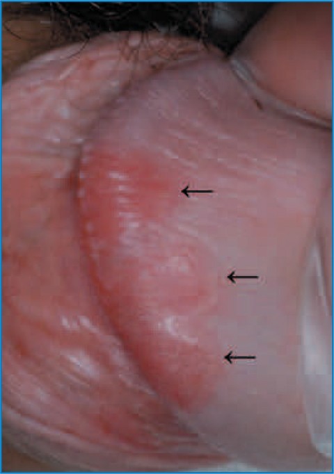 figure 23