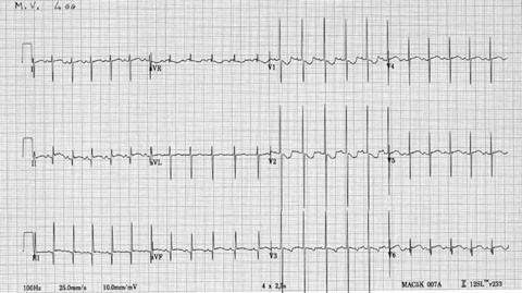 figure 28