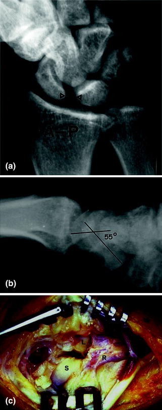 figure 23