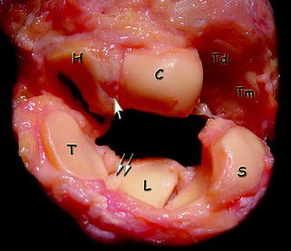 figure 30