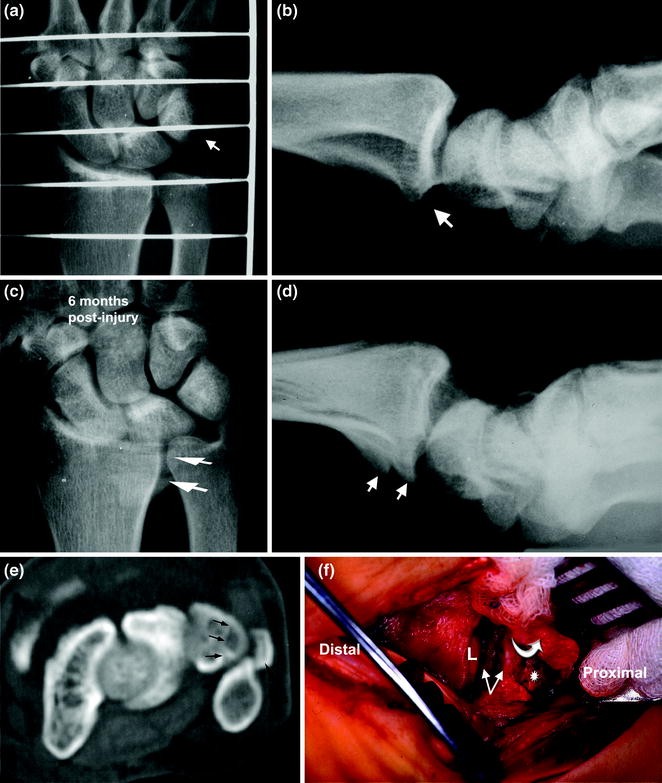 figure 21