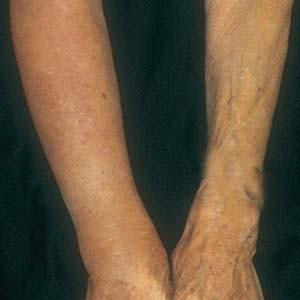 Vaatchirurgie | SpringerLink Vaatchirurgie | Springerlink