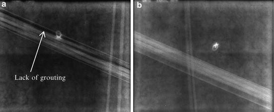 figure 24_7