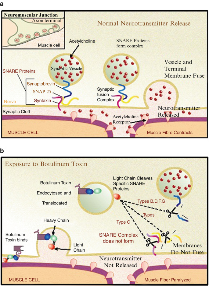 Basic Chemistry of Botulinum Neurotoxins Relevant to Vaccines, Diagnostics,  and Countermeasures | SpringerLink