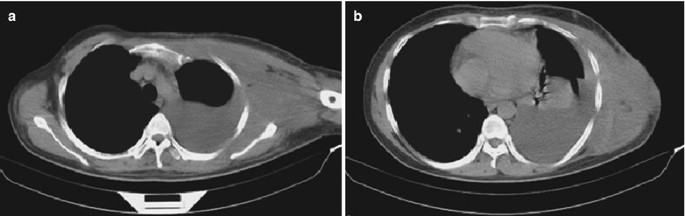 figure 109