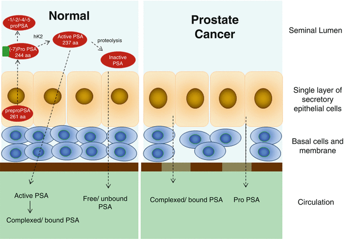 Prostate Specific Antigen as a Tumor Marker in Prostate Cancer: Biochemical  and Clinical Aspects | SpringerLink