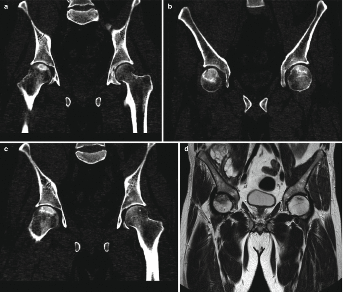 figure 19