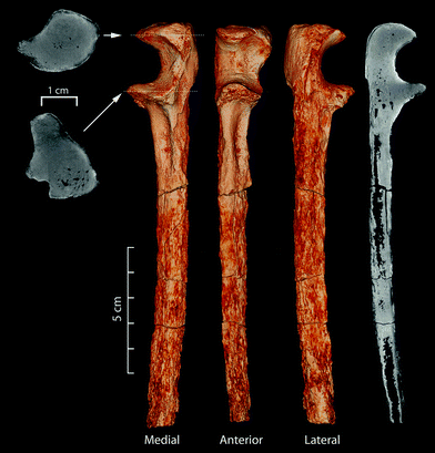 Tibia Duality